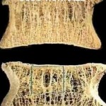 Proteggersi dall’osteoporosi con lo sport