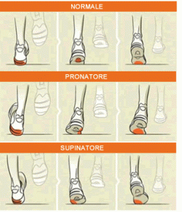 scarpe-pronatori-supinatori